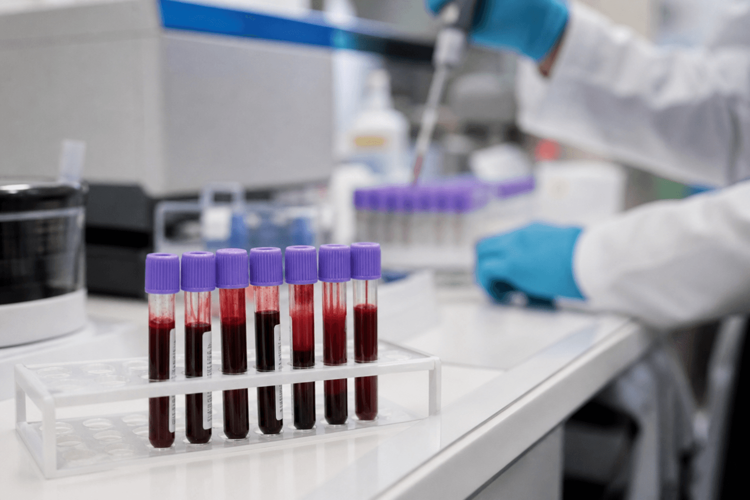 암 조기 발견 혈액검사 '갤러리'…FDA 자문위 긍정 권고