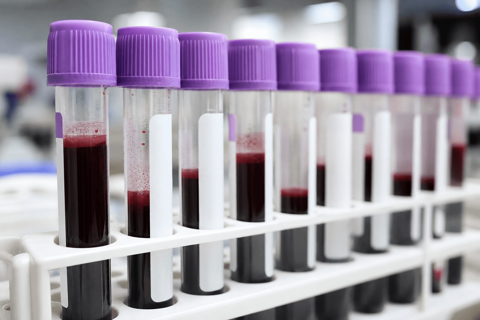 FDA, '베스레미' ET 치료제 승인…28년 만의 신약